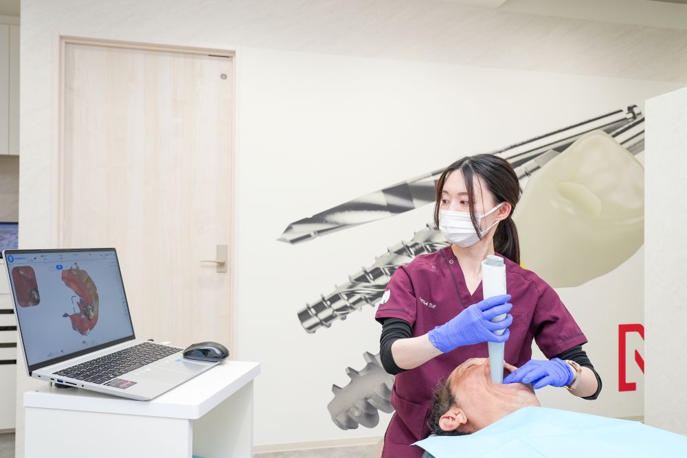 口腔内スキャナによる型取り